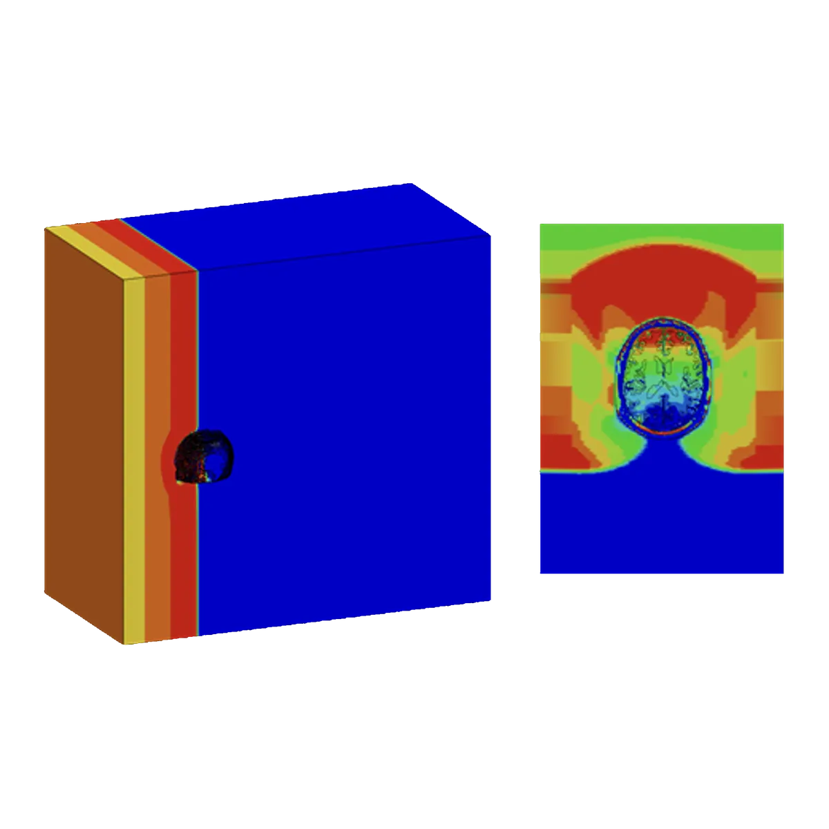 Finite element results comparing a simplified cylindrical skull-and-CSF model (left) with an anatomically detailed head model (right), both showing a region of contrecoup pressure change under blast loading.