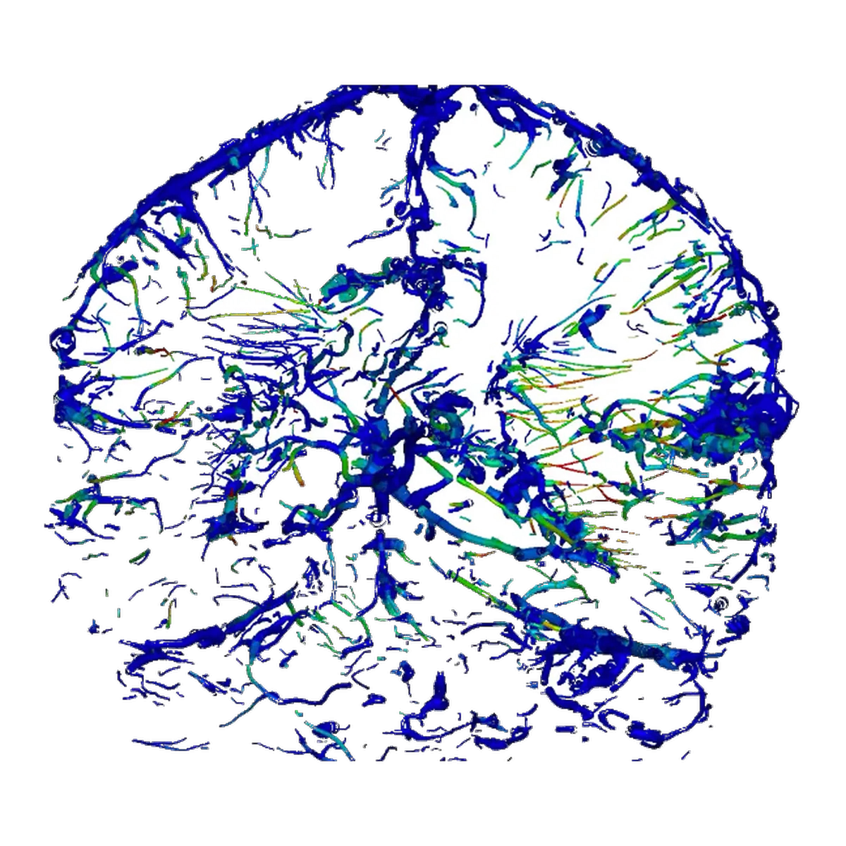 A finite element mesh of the cerebral venous system, coloured by simulated axial strain from a head impact.