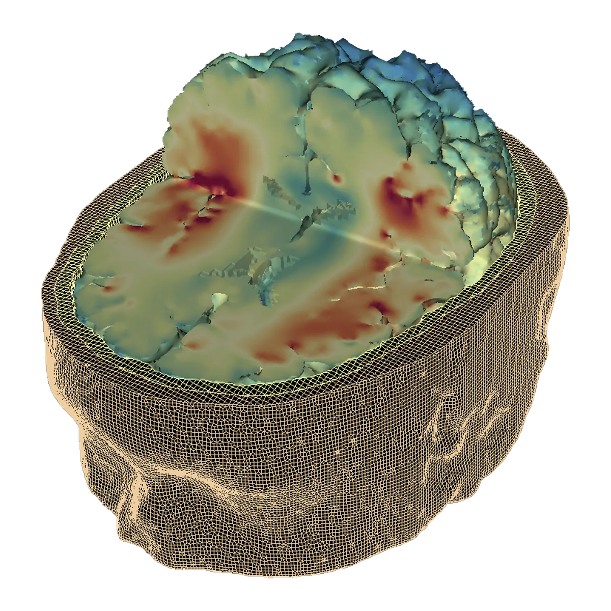 A coronal finite element brain model within the skull mesh, coloured by simulated strain, with peak strain concentrated in cortical regions.