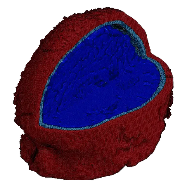 Animated brain model coloured by strain, produced by the PARS pipeline.