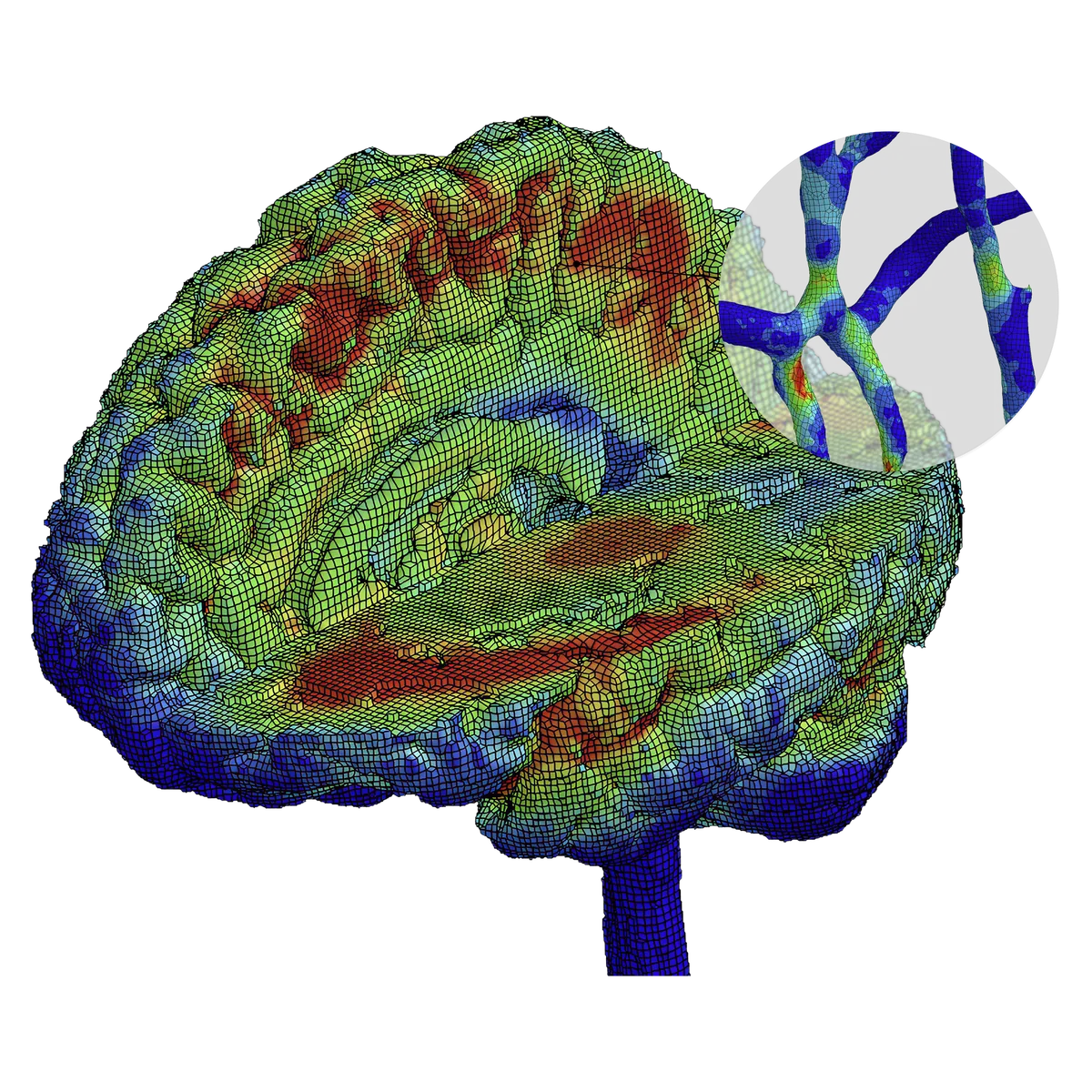 Finite element brain model coloured by strain, with an inset of the modelled cerebral vasculature.